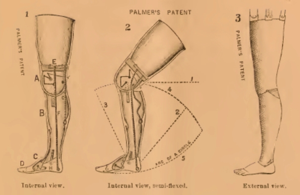 palmers-patent-for-artifical-leg-drawings